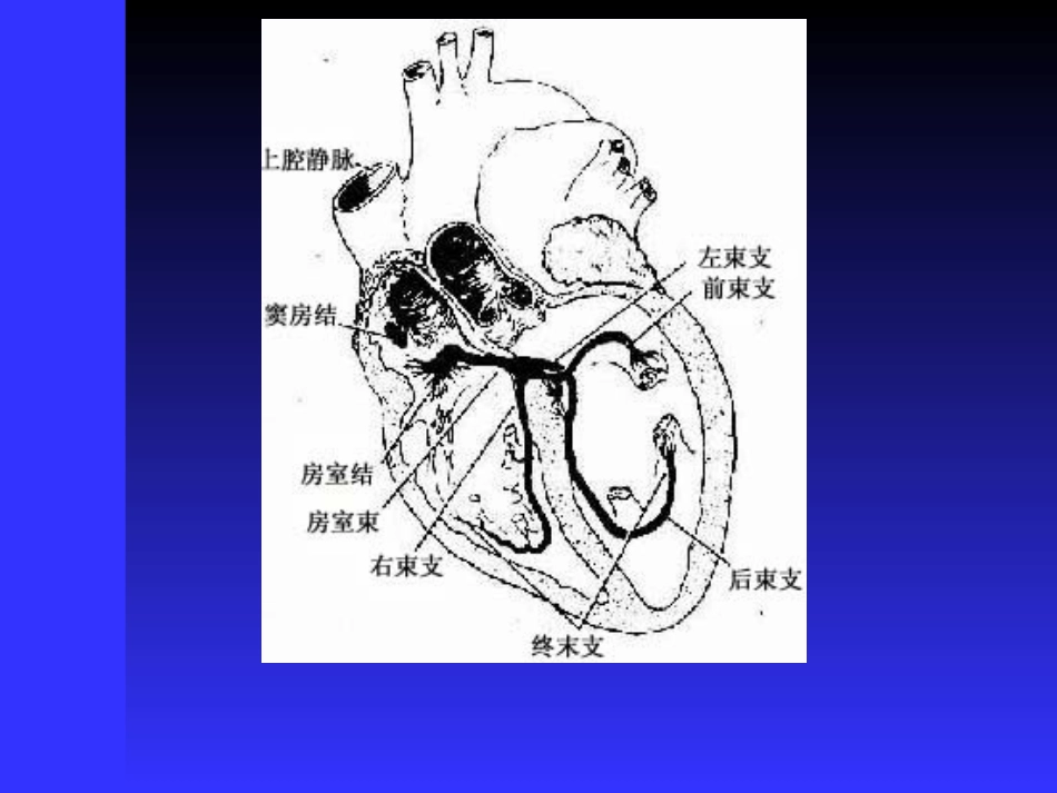 医学课件传导阻滞心电图讲稿_第1页