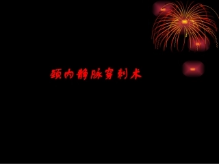 医学课件介入相关的血管穿刺术
