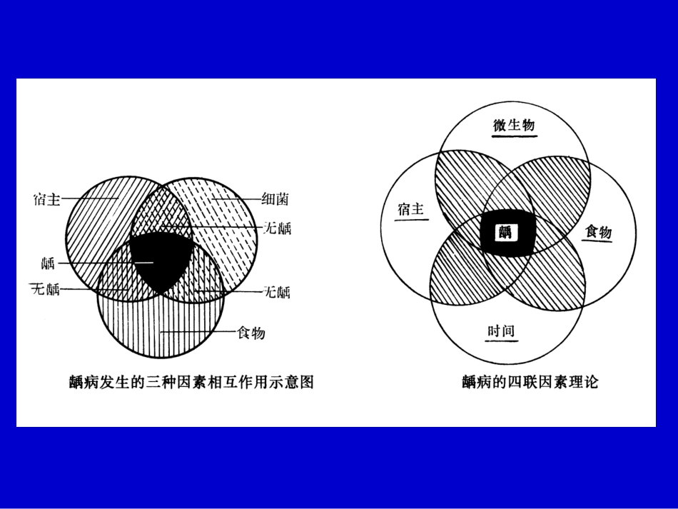 医学课件牙体及牙髓病病人的护理_第3页