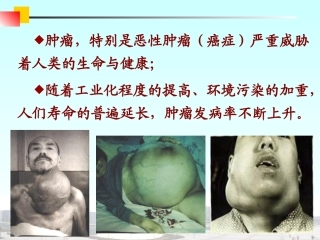 医学免疫学肿瘤免疫