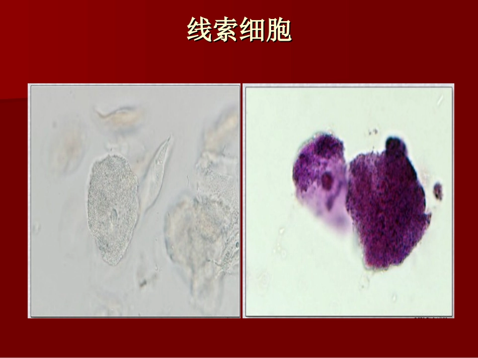 医学尿液图谱宣教专题课件_第3页