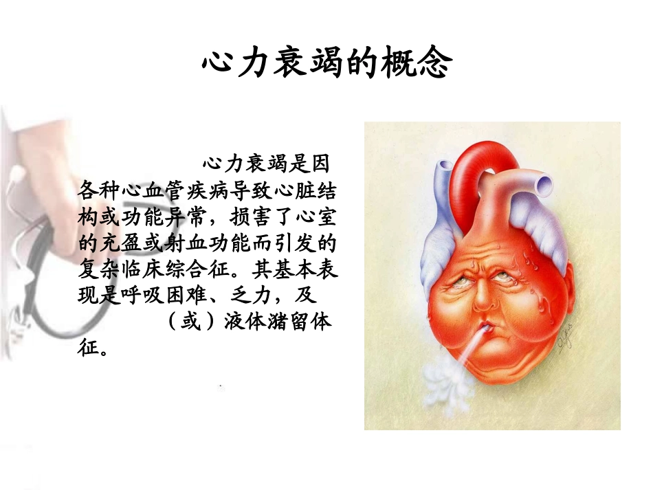 医学心衰病人的观察与护理培训课件_第2页