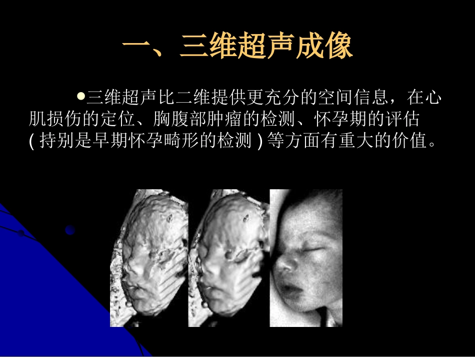 医用超声新技术培训课件_第2页