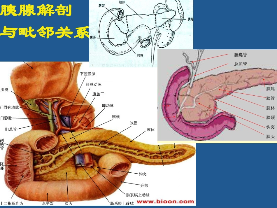 胰腺癌影像诊疗_第3页