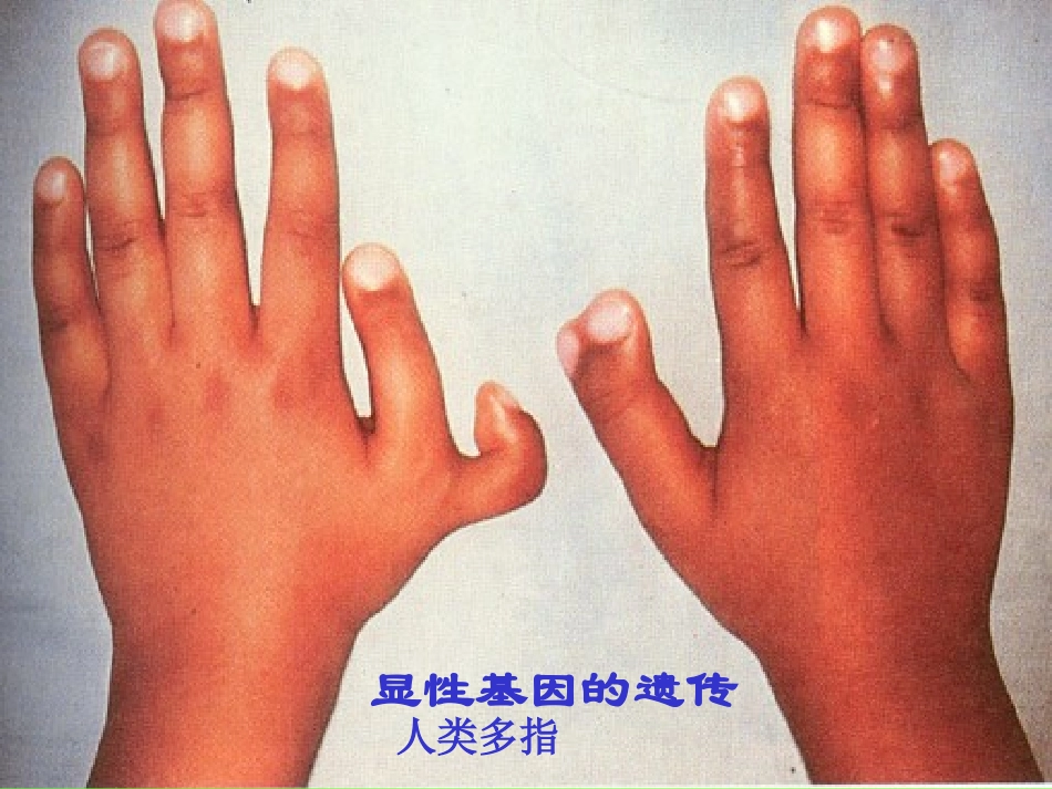 遗传与优生学_第1页