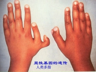 遗传与优生学