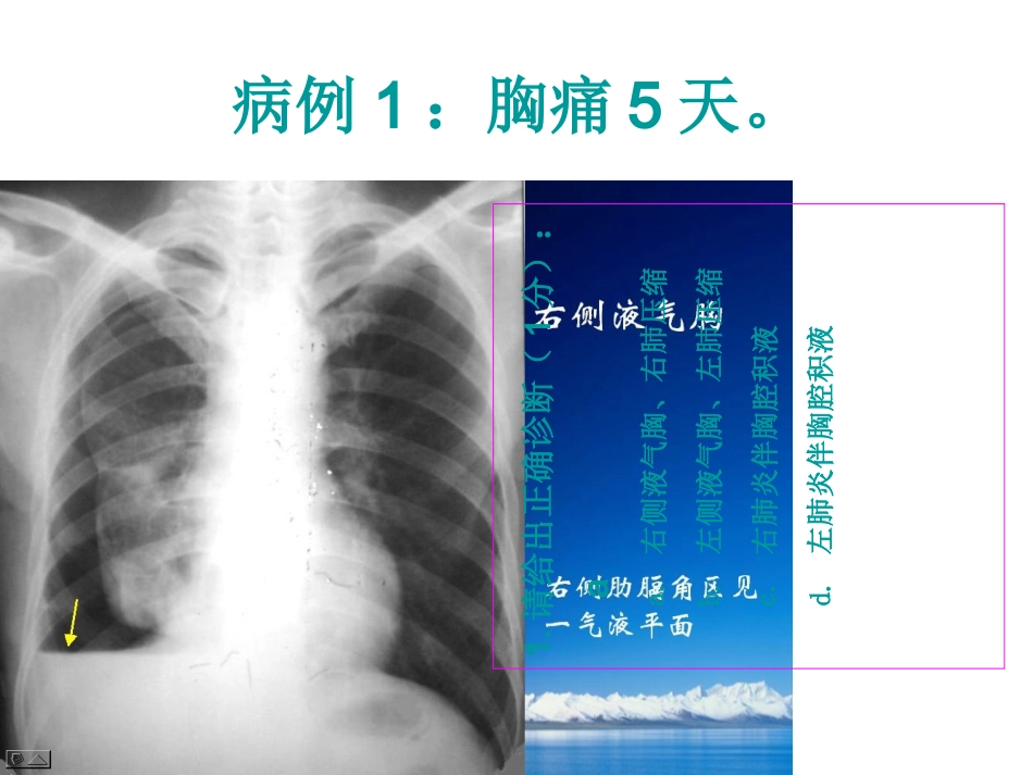 执业医师考试影像阅片培训课件_第3页