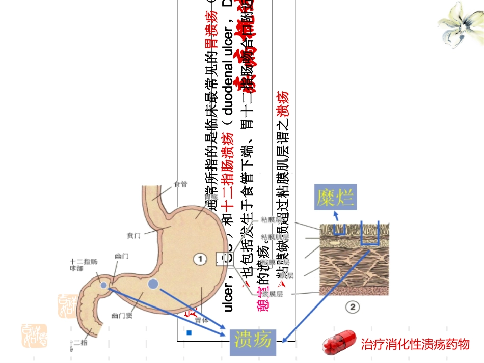 治疗消化性溃疡药物_第3页