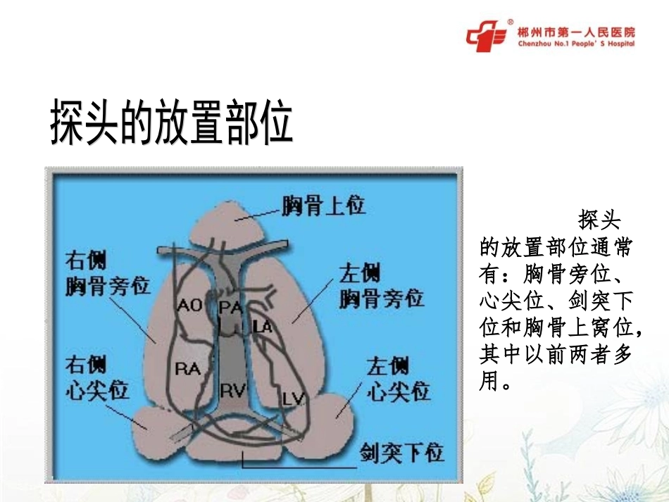 重症心脏超声指南_第3页