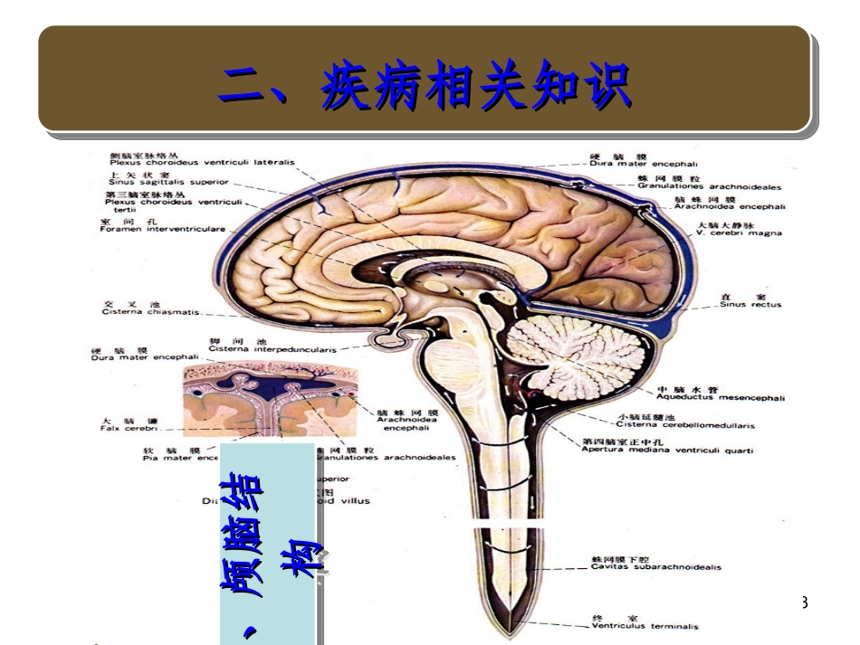 蛛网膜下腔出血的护理查房_第3页