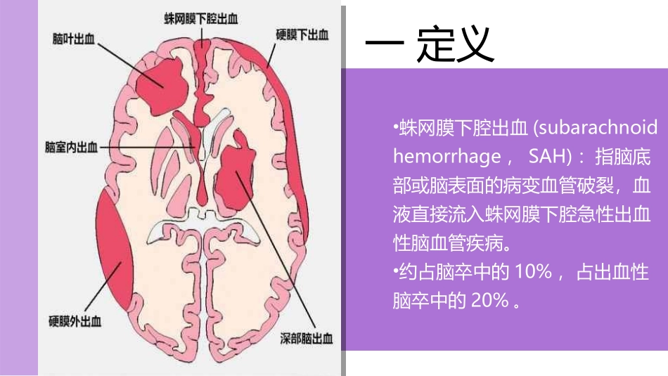 蛛网膜下腔出血护理查房_第3页