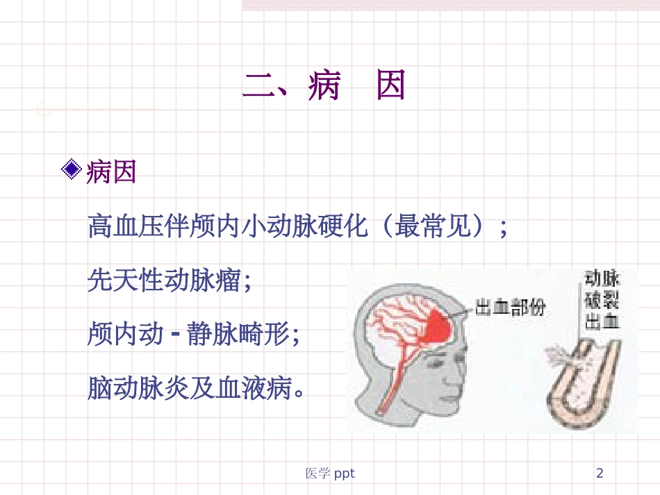 蛛网膜下腔出血及脑出血护理_第2页