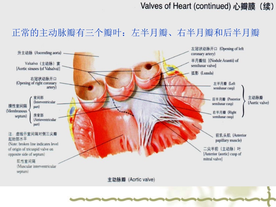 主动脉瓣置换术后的护理_第2页