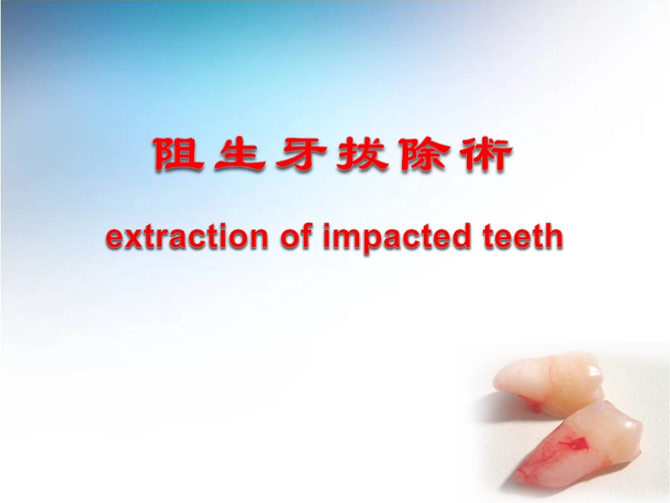 阻生牙拔除术_第1页