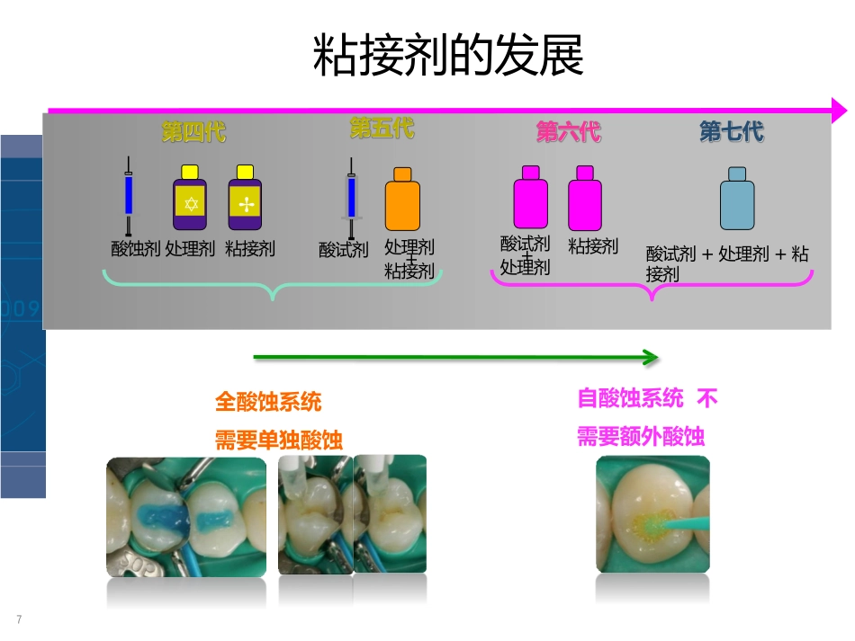 3M树脂微创美学修复_第3页