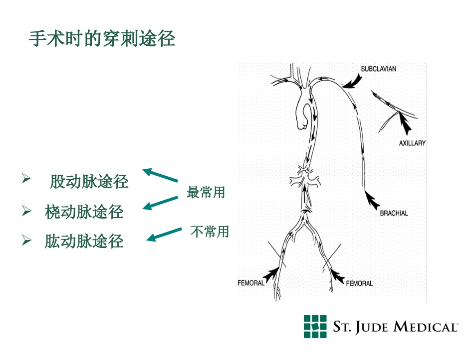 AngioSeal血管封合器_第3页