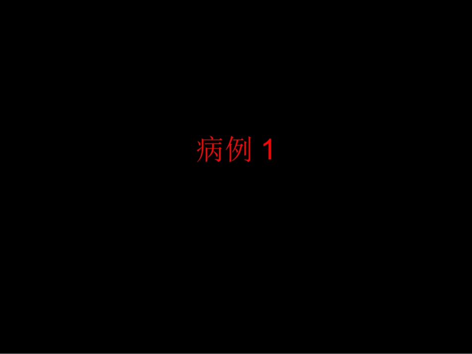Castleman病CT表现_第1页