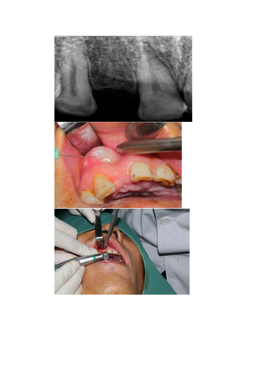 口腔科主要技术介绍_第3页