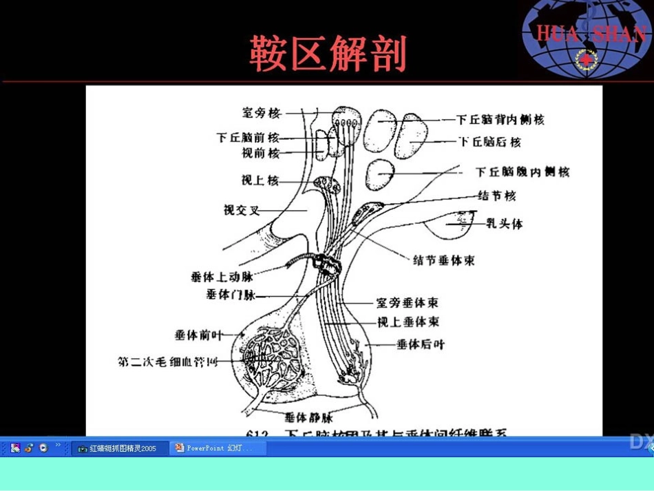 鞍区病变影像诊疗上_第3页