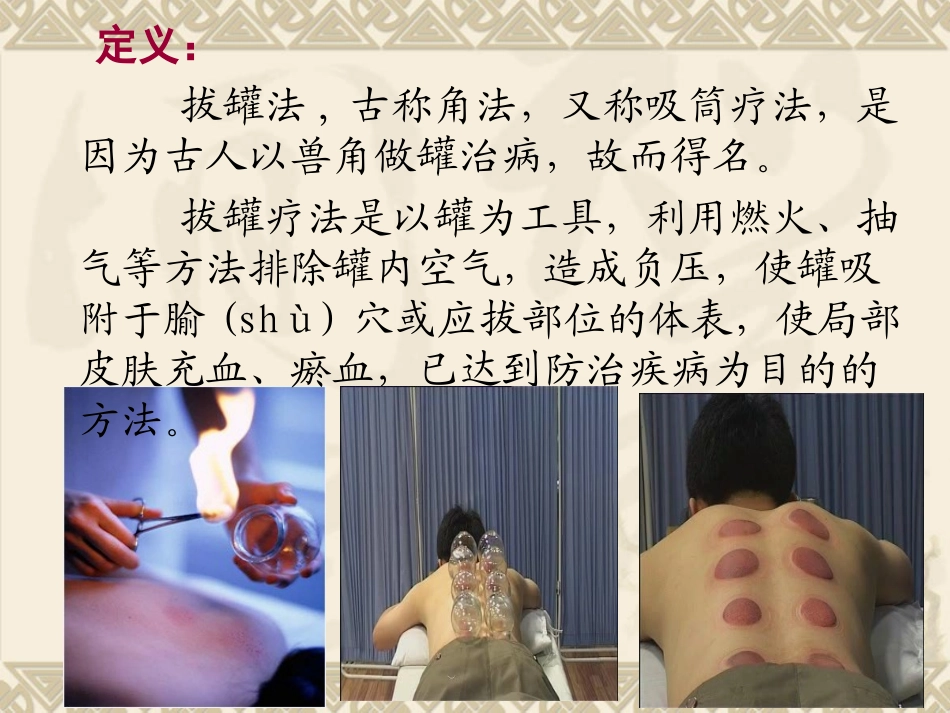 拔罐培训课件_第3页