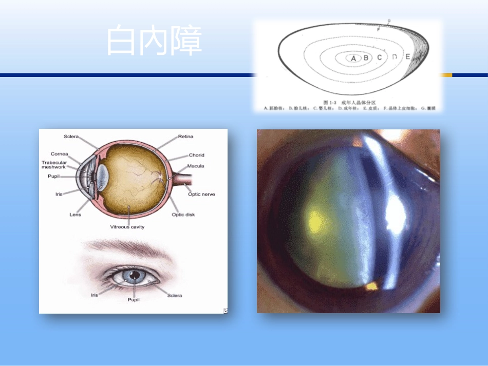 白内障手术操作技巧_第2页