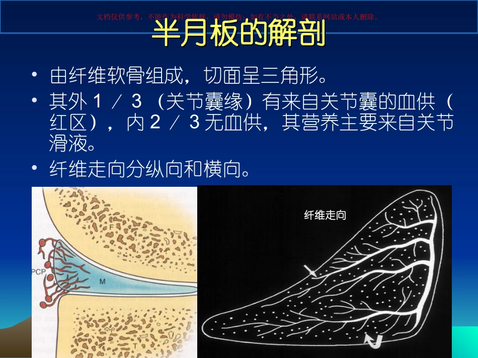 半月板损伤标准课件_第2页