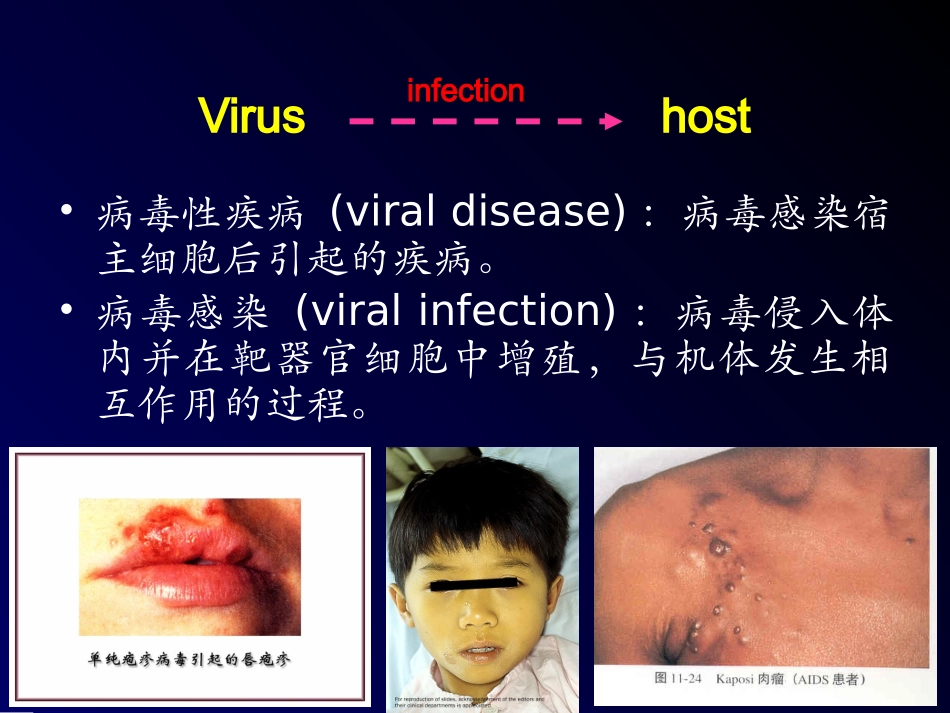 病毒的感染与免疫_第3页