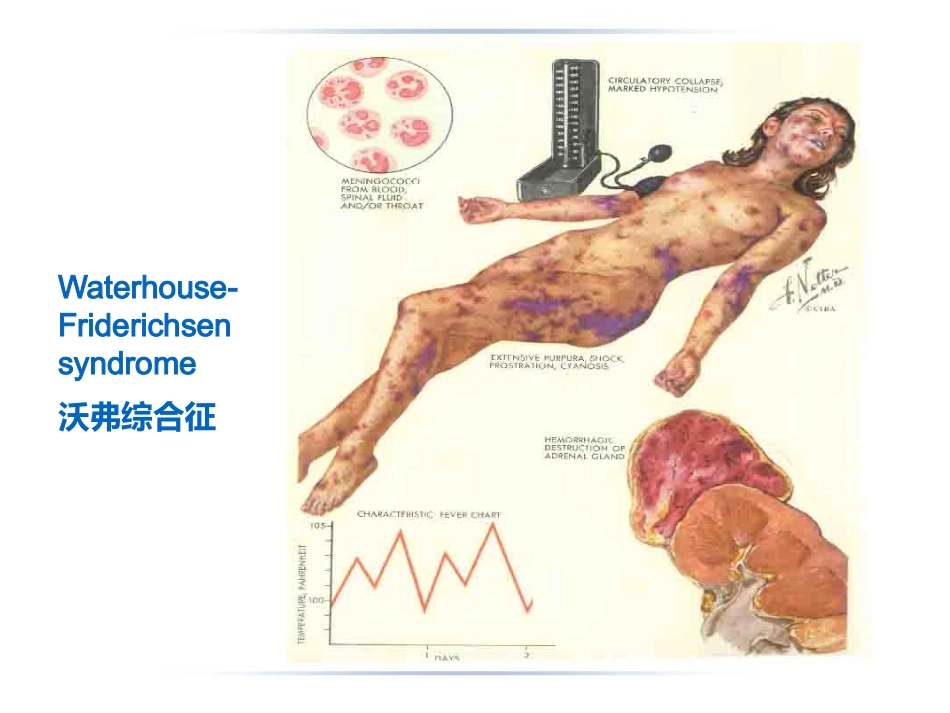 病理生理学DIC_第2页