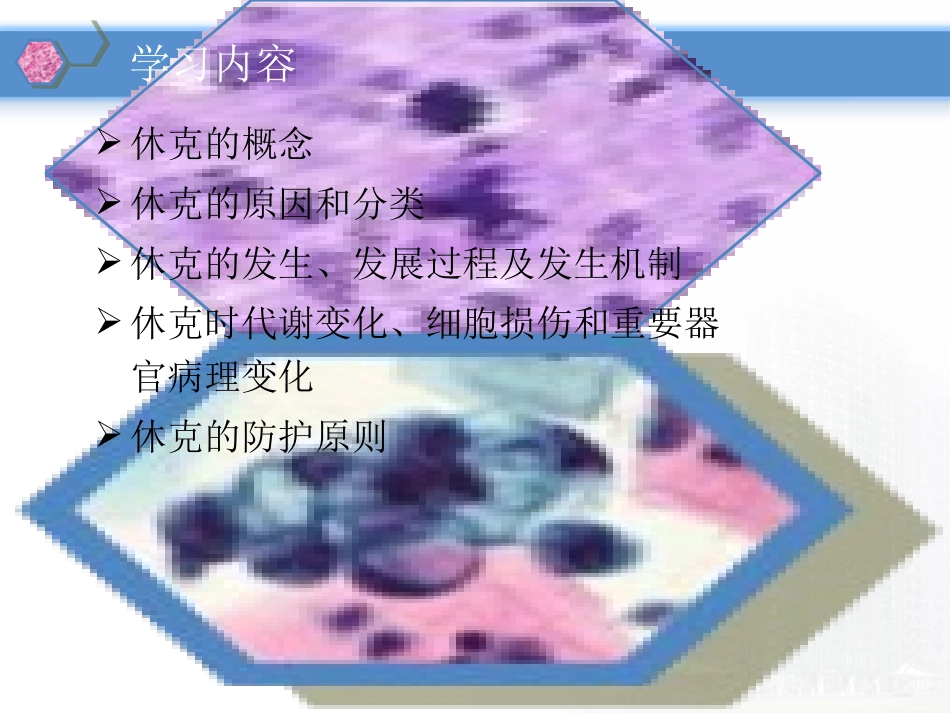 病理学与病理生理学休克_第2页