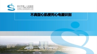 不典型心肌梗死心电图识别