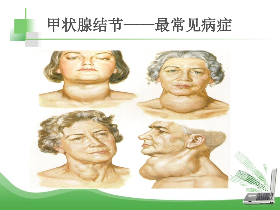 常见甲状腺疾病的中西医诊治_第2页