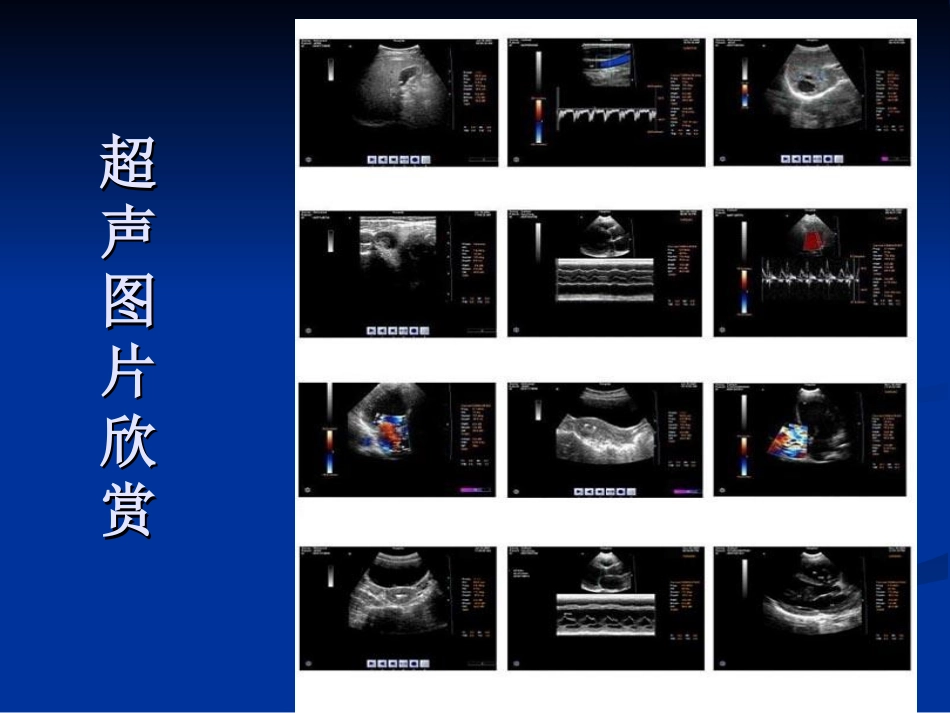 超声检查及解读报告_第2页