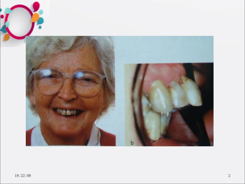 成人正畸课件_第2页