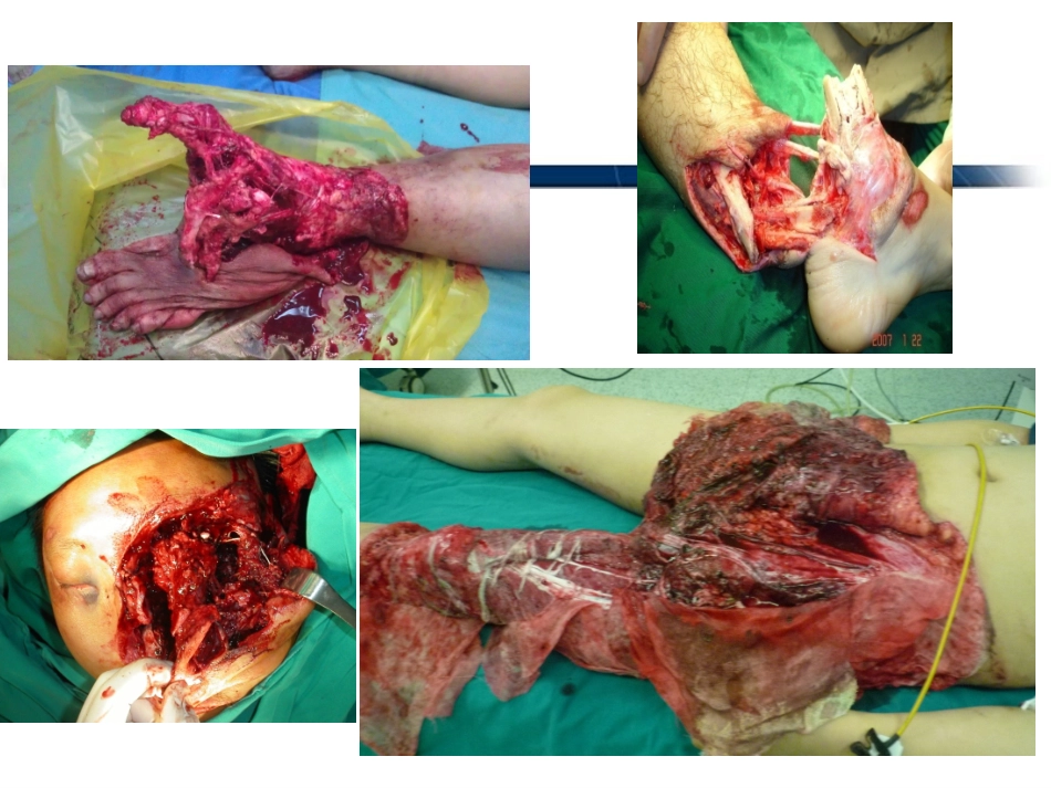 初级创伤救治_第2页
