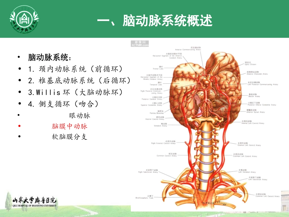 穿支动脉梗死_第3页