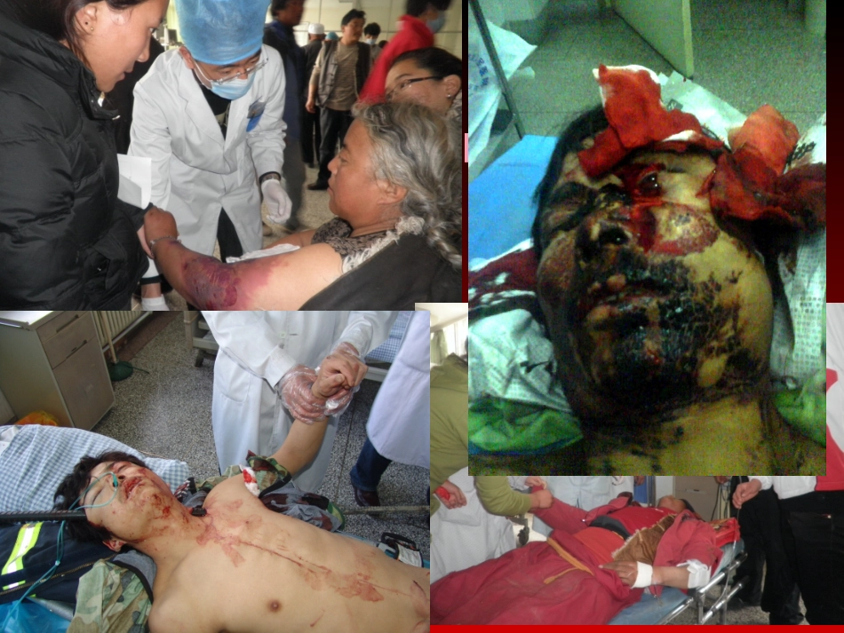 创伤的分级救治课件_第3页