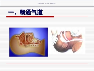 创伤急救五大技术