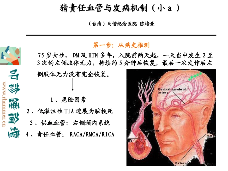 从影像学梗死部位推测责任供血血管讲义_第2页