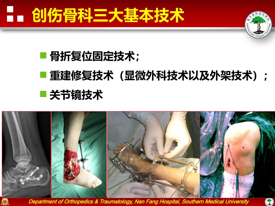 带蒂皮瓣转移修复足踝部创面_第2页