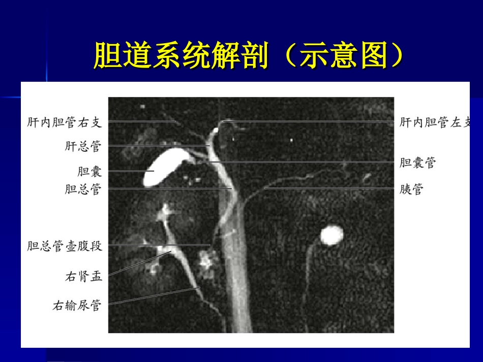 胆道梗阻的影像学诊疗讲义_第3页