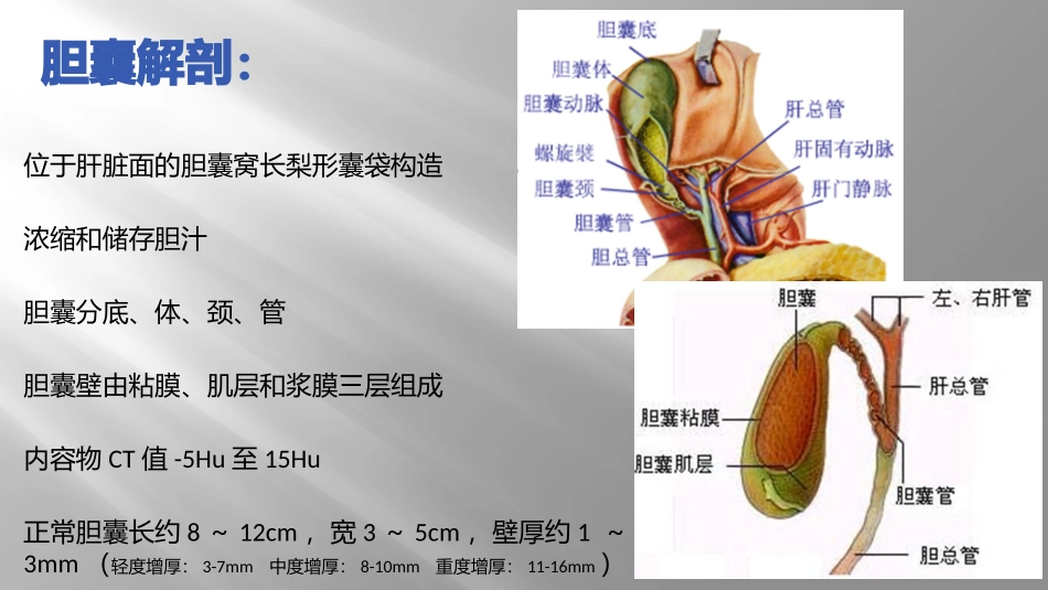 胆囊壁增厚性病变CT诊断与鉴别诊断_第2页