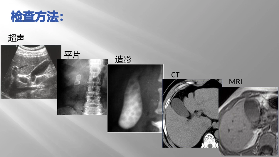 胆囊壁增厚性病变CT诊断与鉴别诊断_第3页