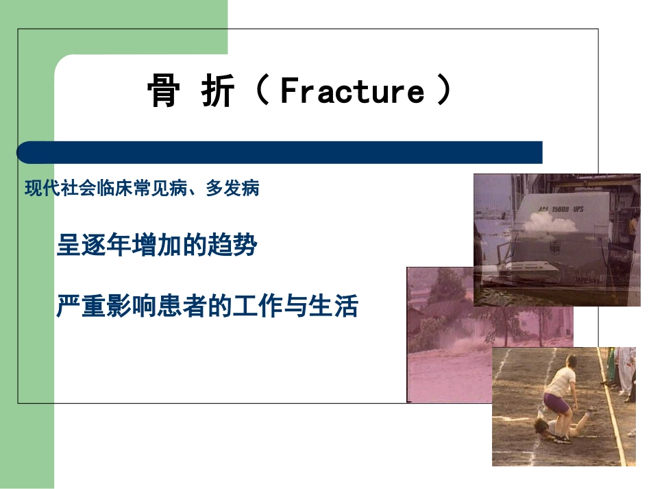 第一节骨与关节损伤_第2页