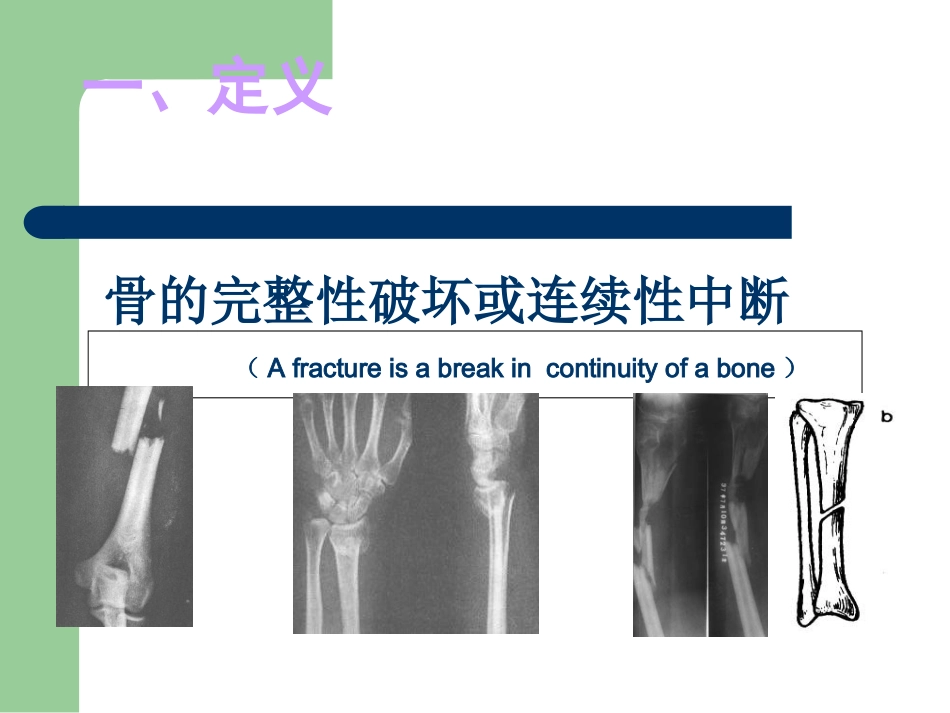 第一节骨与关节损伤_第3页