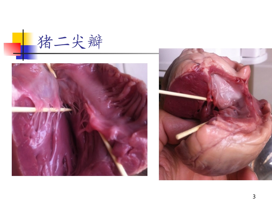 第章心脏瓣膜病内科学第版培训课件_第3页