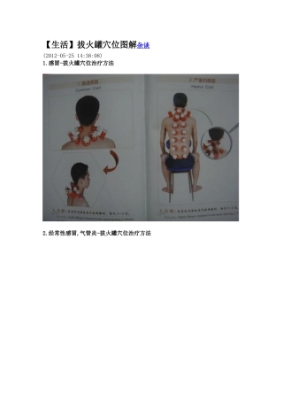 拔火罐穴位图解杂谈