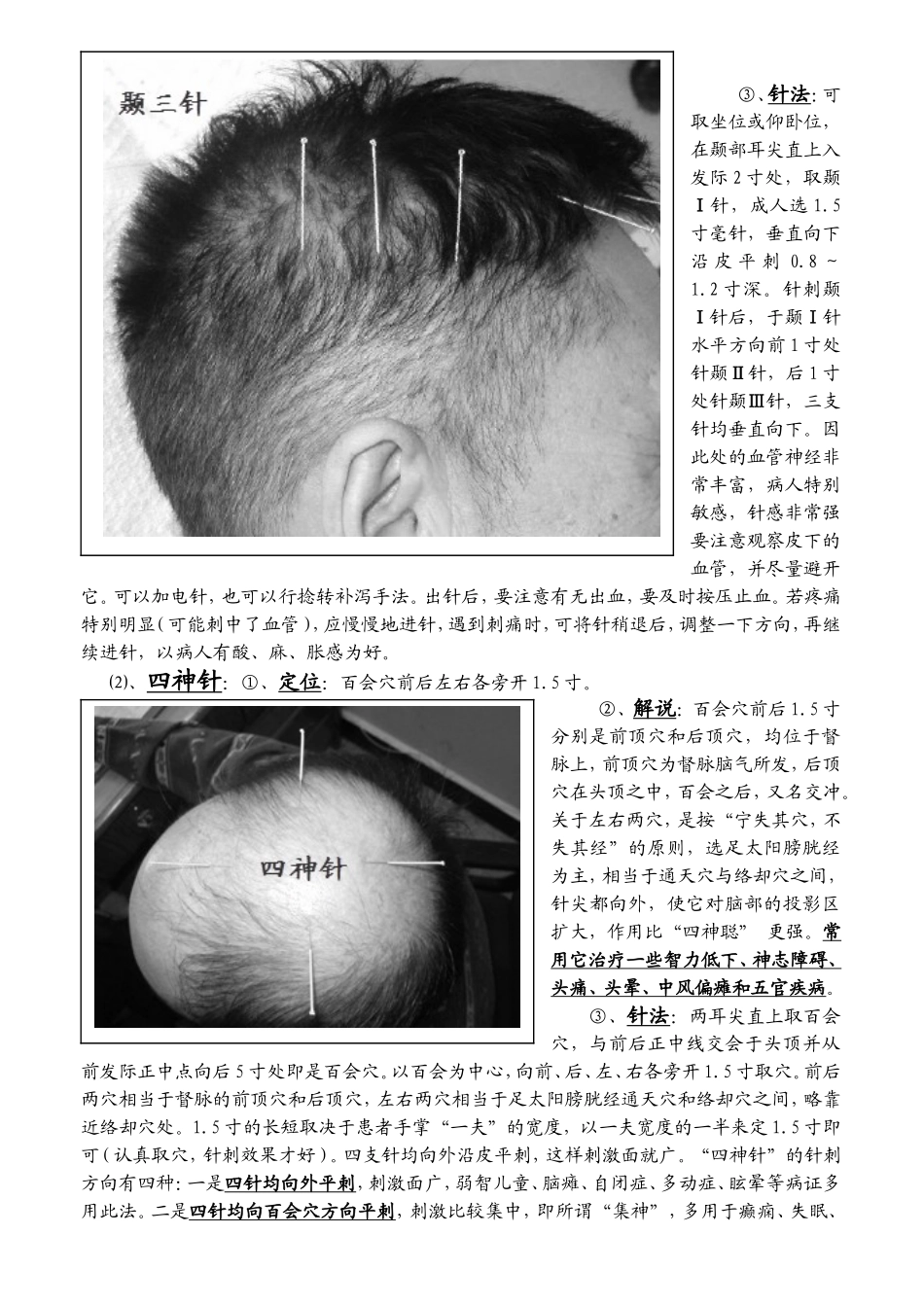 靳三针疗法 针灸手册_第2页