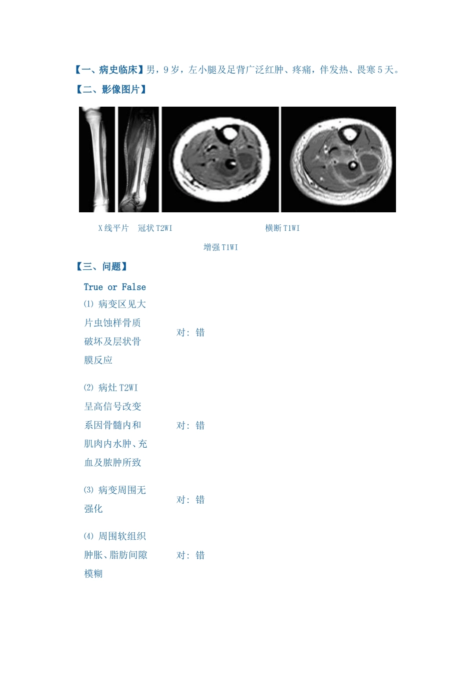 急性化脓性骨髓炎 临床病历_第1页