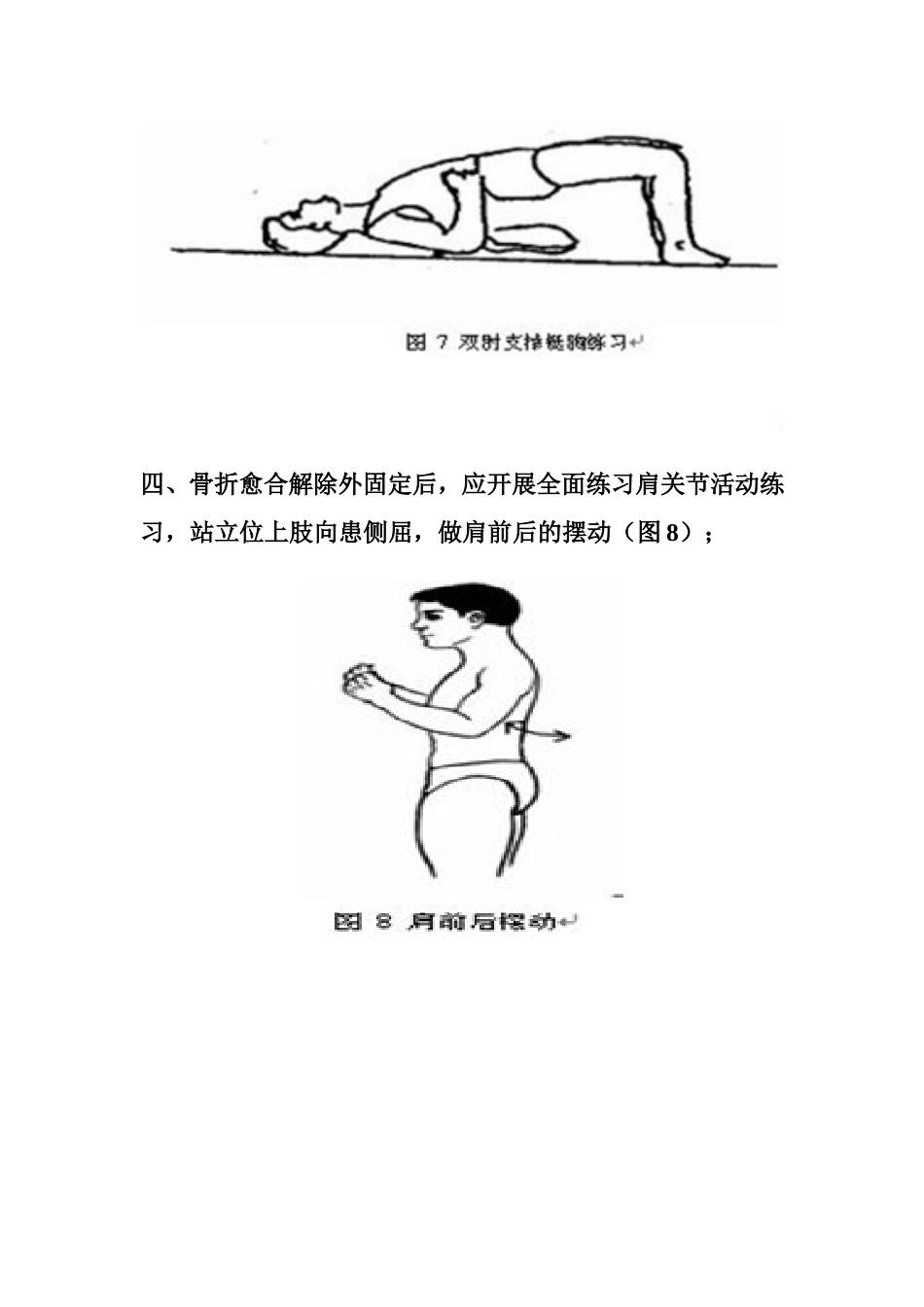 锁骨骨折康复锻炼健康图谱_第3页