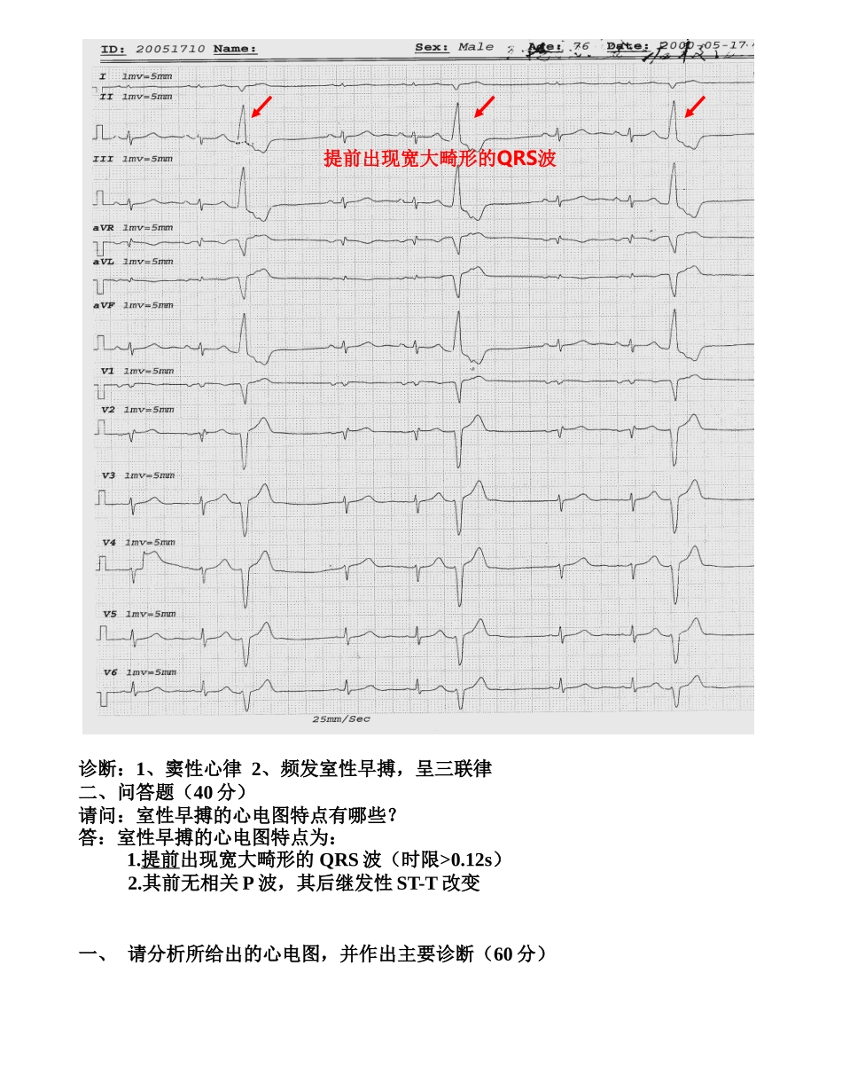 市工人医院临床“三基”考试心电图复习题_第3页